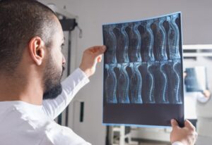 Radiologist analyzing x-ray